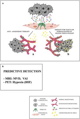 Anti-angiogenic Therapy in Cancer: Downsides and New Pivots for Precision Medicine